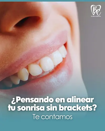 tarjeta que habla sobre los bracker